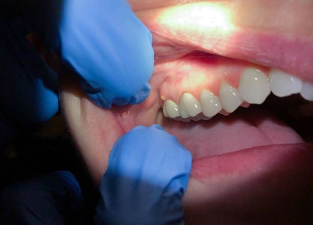 Best Orthodontic Emergency Dentist in St Stephens, NC