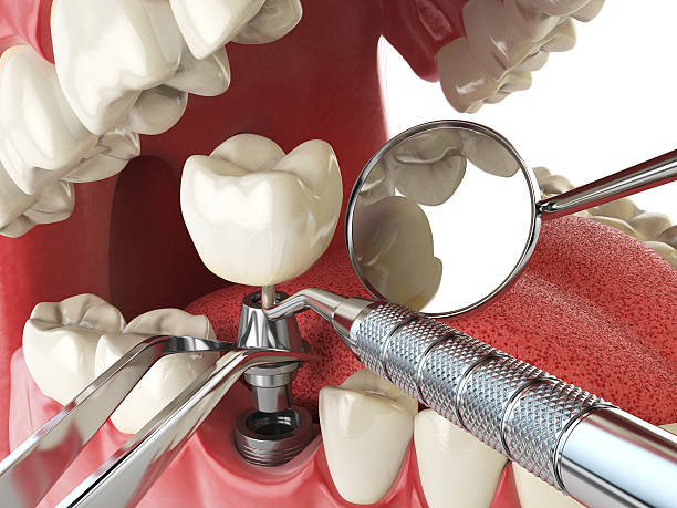Best 24-Hour Emergency Dentist in St Stephens, NC